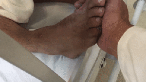 Left Clonus How to Tell Apart Central and Peripheral Nervous System Injuries – The ...