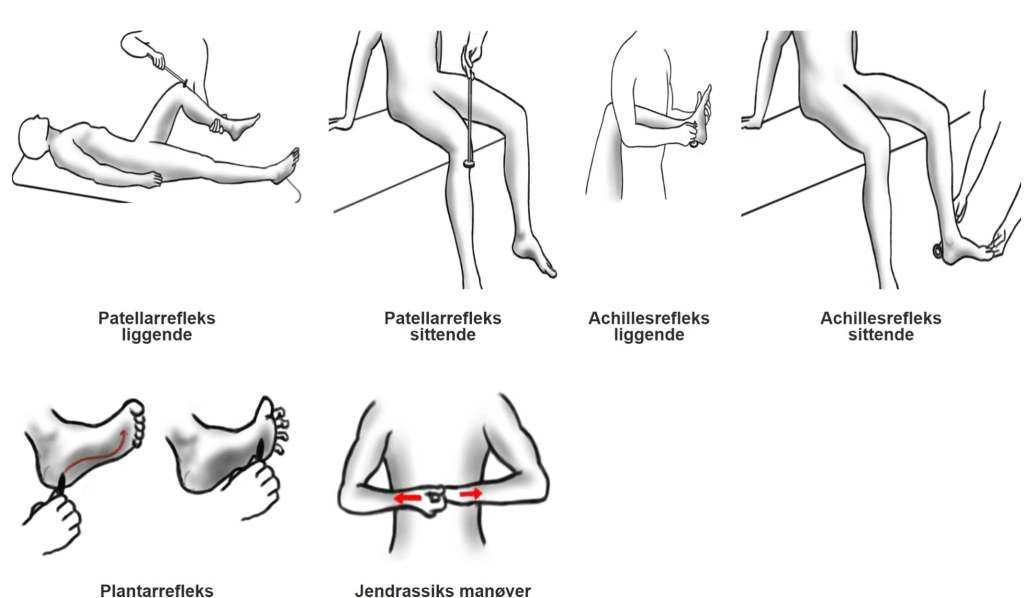 The ABC of reflex testing – The Scandi Physio – Simen Sletten