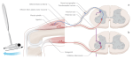 Reflex Testing Methods The ABC of reflex testing – The Scandi Physio – Simen Sletten