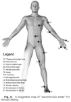 Derma Ms Map Sensory exam, part 3: Which dermatome map is the best? – The Scandi Physio